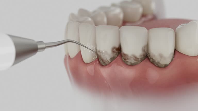 Reliable Dental Implants contractor in Rowland Heights, CA by Smile Center Dentistry